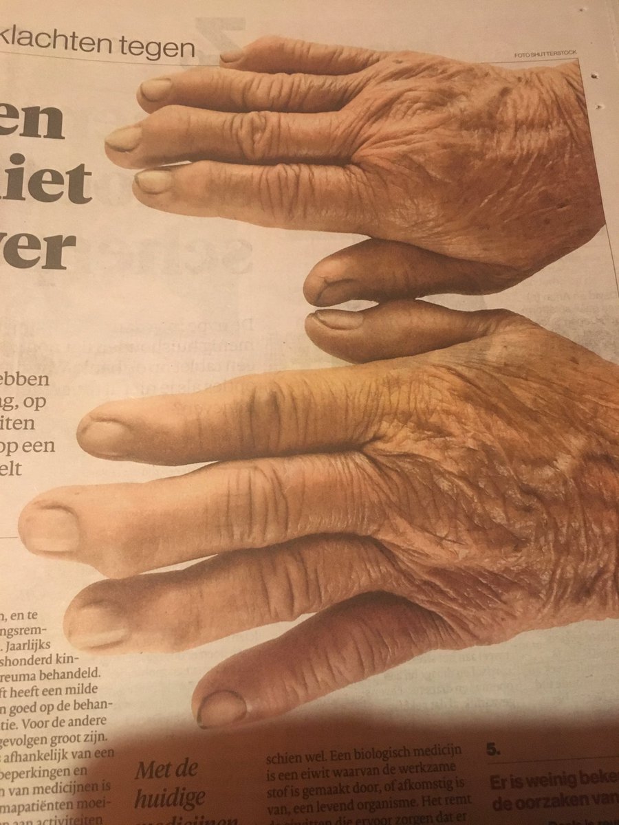 Vandaag is het #wereldreumadag In het <a href="/AD_GroeneHart/">AD Groene Hart</a>  een foto met #artrose #handen
Maar zulke “vieze nagels” ,op een foto, is echt heel erg!
Volgende week is het internationale dag van het handen wassen! Ik hoop dat de #beeldredactie niet per ongeluk dezelfde foto gebruikt!
