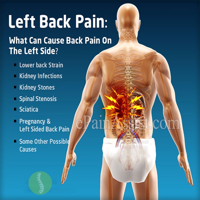 Lower Left Back Pain