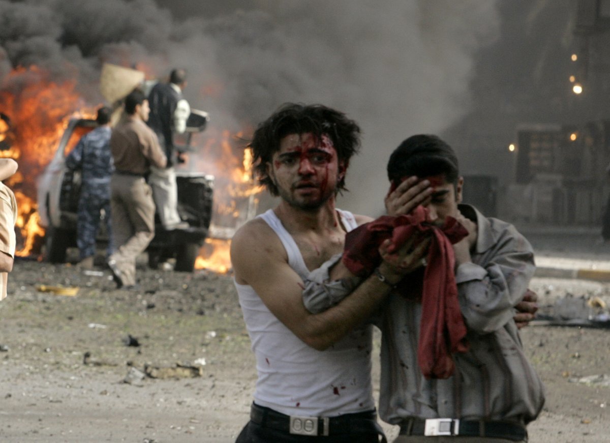 Victim of a car bombing walks away in Baghdad, Iraq. 2007