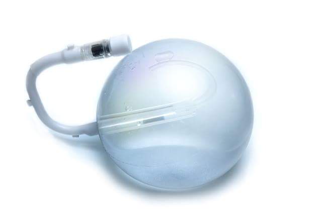 STUTTGART Magenballon 24.10.2019 Donnerstag, Sprechstunde Eingriffstermine im OP-Zentrum MEDIZI Stuttgarter Straße 33-35, 70469 Stuttgart-Feuerbach. Kontakt: 01727126959
#Magenballon #Schluckballon #Softballon #Luftmagenballon #Jahresballon