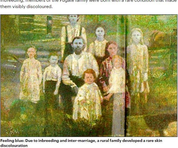 トカナ Tocana 知的好奇心の扉 公式 朝起きると突然 血が真っ青になった25歳女性 青い肌の一族 ファゲイト と同じ症状か ヤバすぎる原因は 一家全員まっ青な肌 近親婚を繰り返したファゲイト一族の悪夢が再び T Co Kx19cj0lrj