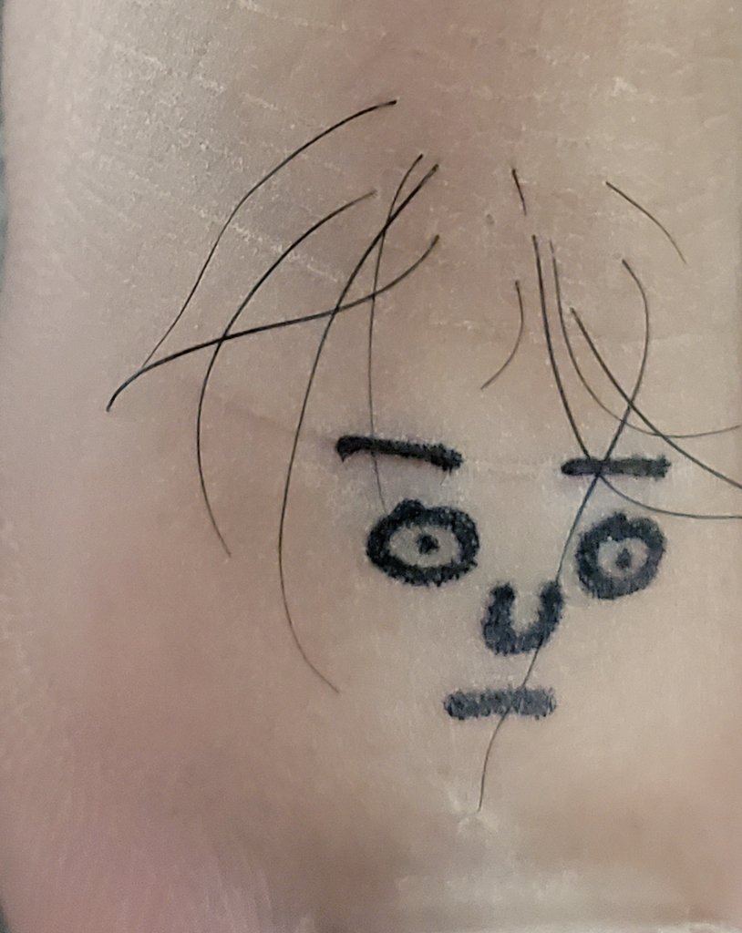takki0224's tweet photo. うたた寝をしてまって起きたらビックリ！？

足の親指に「ハゲあがった人の顔」が

息子達の仕業か！！起きたら、爆笑だった
ってか指汚くてごめんなさい https://t.co/2hH7SY9kqJ