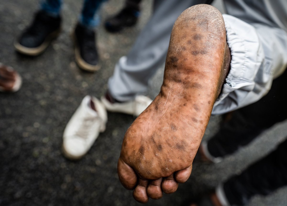 coopsrun's tweet photo. Any runners got an old pair of trainers they’d donate ? I met a load of refugees in Calais yesterday with foot rot as they have wet feet, sleeping rough and have walked for WEEKS. #ukrunchat #footwear @UKRunChat https://t.co/H1P2PDqDLh