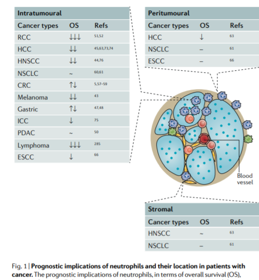 How important are tumor-associated neutrophils in cancer? Check out this review <a href="/NatRevClinOncol/">NatureRevClinOncol</a> 
nature.com/articles/s4157…