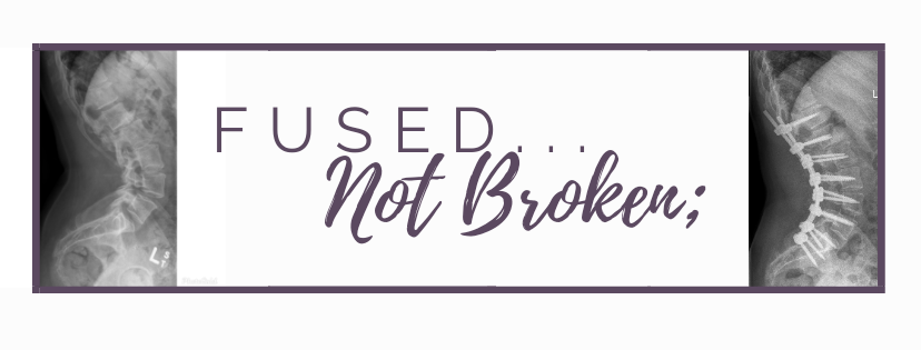 fusednotbroken's tweet image. Got my About Me page roughly finished. Let's do this!! #doingitscared #spinalfusion fusednotbroken.com/about-me/