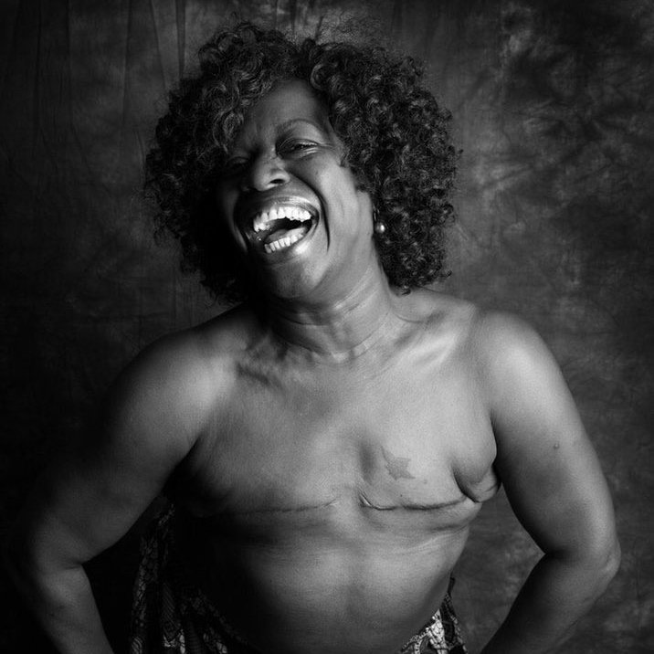 Lytevents1's tweet photo. Know the real meaning for #nobraday
#NoBraDay is
to show empathy and solidarity with women who have had mastectomies due to breast cancer and they CAN'T wear bras. Example 👇 https://t.co/8y2BmuIUw3