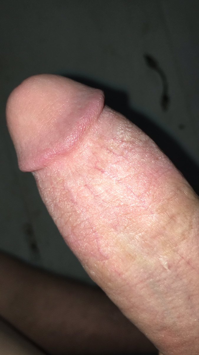 dmmetoswappics's tweet photo. So horny rn #horny #nudes #tradenudes #dickpic #wankchat https://t.co/y7Z1m8eqNn