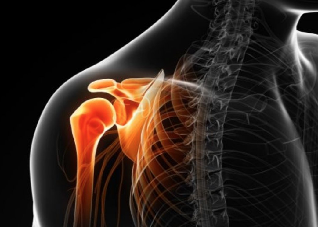 What do these symptoms mean?

Shoulder pain and weakness, pain at night and at rest when lying on the affected shoulder, pain when raising, lowering and rotating the arm, popping or cracking sensation…

#ROTATORCUFFINJURY
medilink.us/fdge