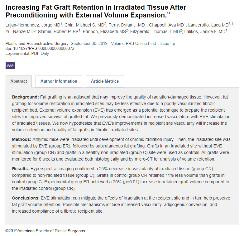 Northwestern Surgery (@nmsurgery) on Twitter photo #JustOut in <a href="/prsjournal/">Plastic and Reconstructive Surgery</a> by #plasticsurgery #resident Ava Chappell, MD when she was still @UMassMedical: Increasing Fat Graft Retention in Irradiated Tissue After Preconditioning with External Volume Expansion buff.ly/2pVNOao Proud of our publishing <a href="/purplesurg/">NW Gen Surg Residents</a> ⭐️ #JustOut in <a href="/prsjournal/">Plastic and Reconstructive Surgery</a> by #plasticsurgery #resident Ava Chappell, MD when she was still @UMassMedical: Increasing Fat Graft Retention in Irradiated Tissue After Preconditioning with External Volume Expansion buff.ly/2pVNOao Proud of our publishing <a href="/purplesurg/">NW Gen Surg Residents</a> ⭐️