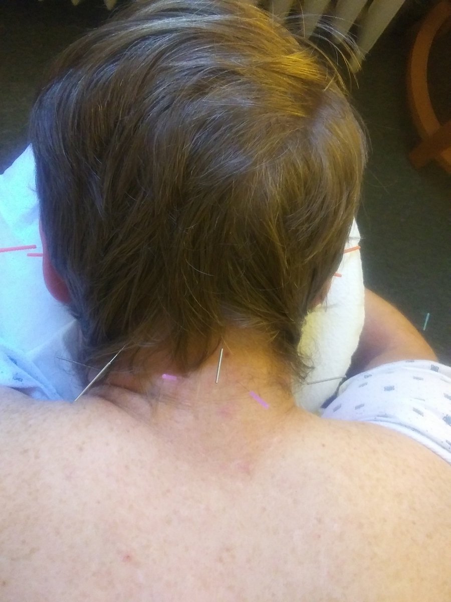IMCithaca's tweet image. Feeling like somethings a pain in your neck?  Visit Integrative Medicine Center at Ithaca with Katerina Naumenko, LAc.  #acupuncture #herbs 
@IthacaCollege
 
@Cornell