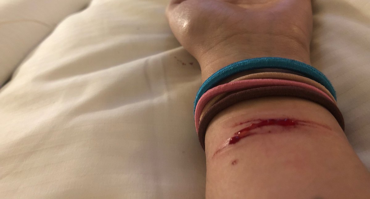 Glasssshards's tweet image. *trigger warning*