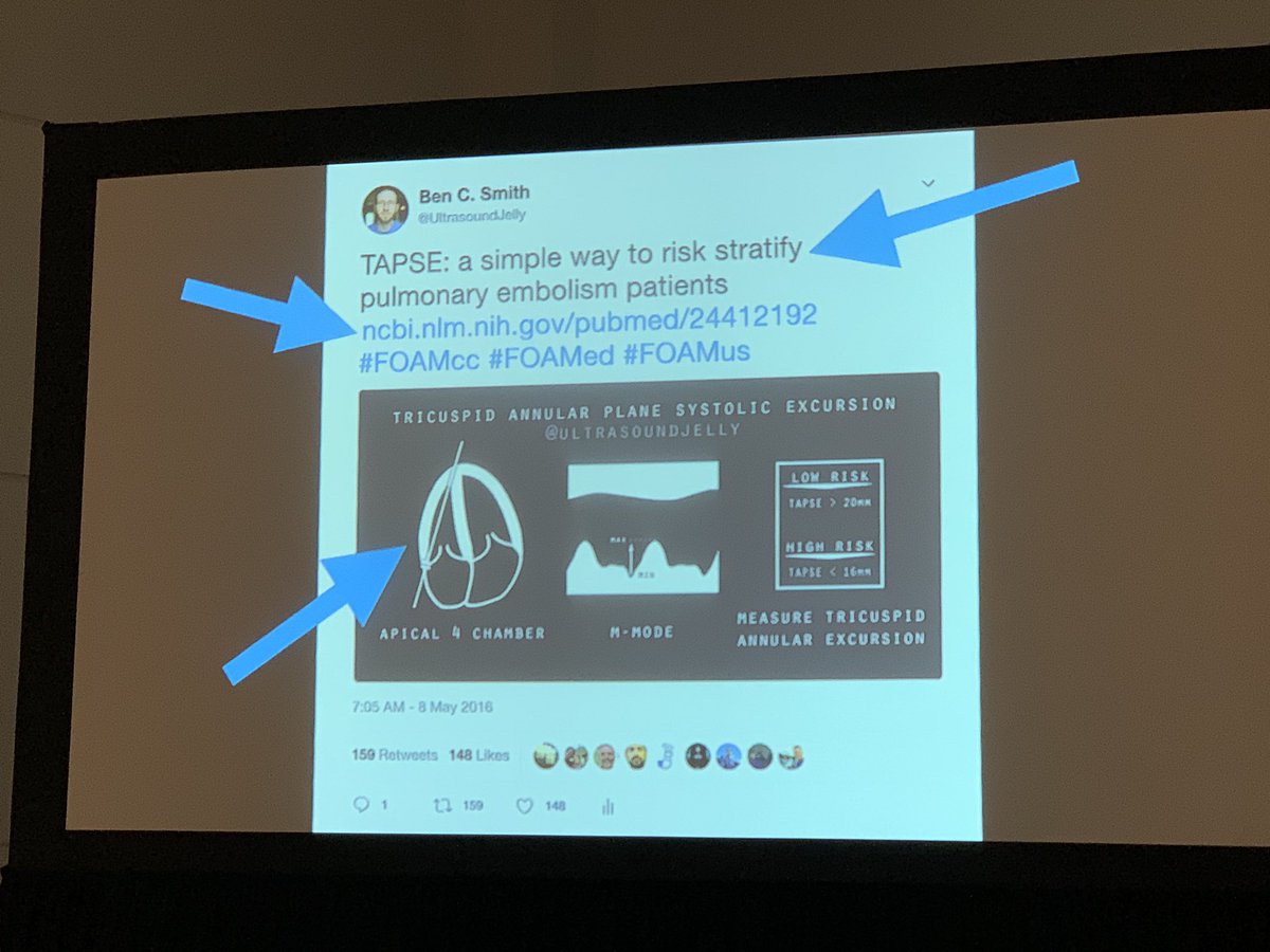 bretpnelson's tweet photo. Anatomy of a great tweet by @UltrasoundJelly Ben Smith
1. Useful fact
2. Link to reference
3. Graphic
#ACEP19 #educacion https://t.co/NY1ED60KYc