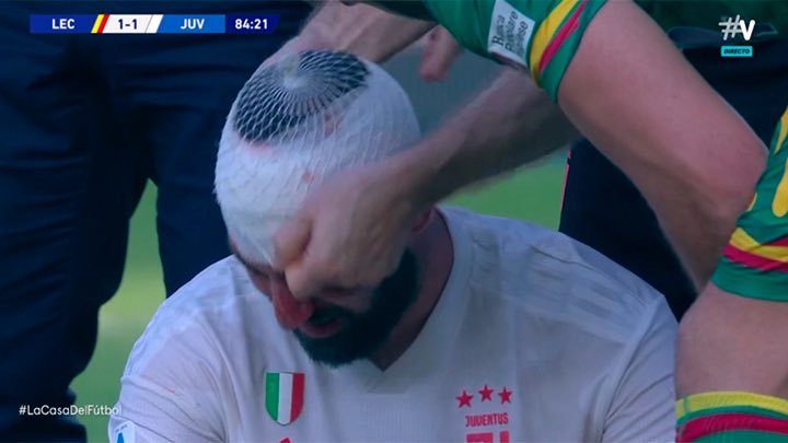 forumJuventus's tweet photo. Higuain dopo il fischio finale di #LecceJuve si è accasciato a terra ed è stato portato in ospedale per accertamenti dopo la botta alla testa rimediata da Gabriel. Forza Pipita 💪🏻 https://t.co/KKrQxVKDor