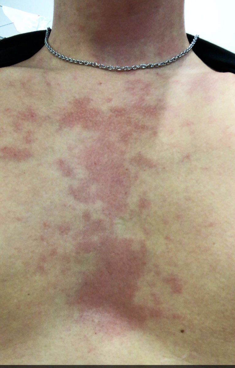 Bennnzz 🎂 tweet media