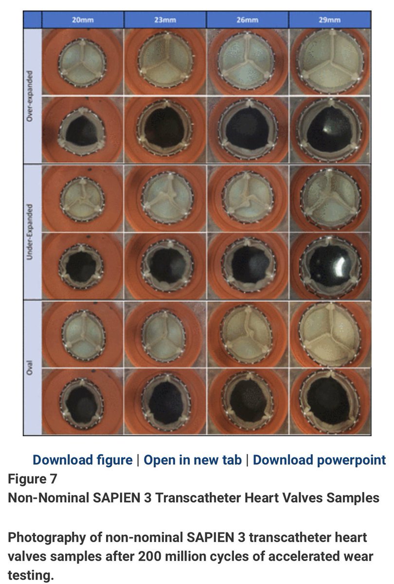 #Sapien3 #TAVR tested 1billion cycles=25y shows minimal failure equivalent to Magna Ease SAVR valve. Changing valve geometry no major impact. Thoughts on durability? Transferable to pts? Nice work Vancouver group. @pomyers @igeorge1975 @TsuyoshiKaneko1 interventions.onlinejacc.org/content/early/…