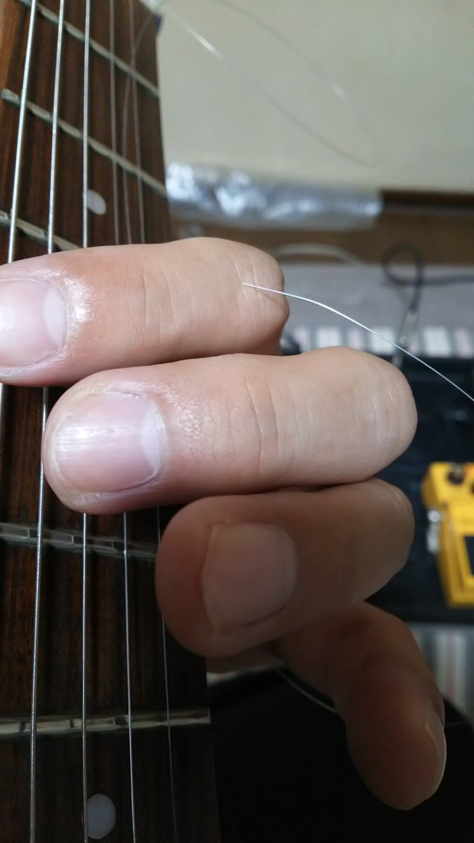 イテッ！！(>_<)