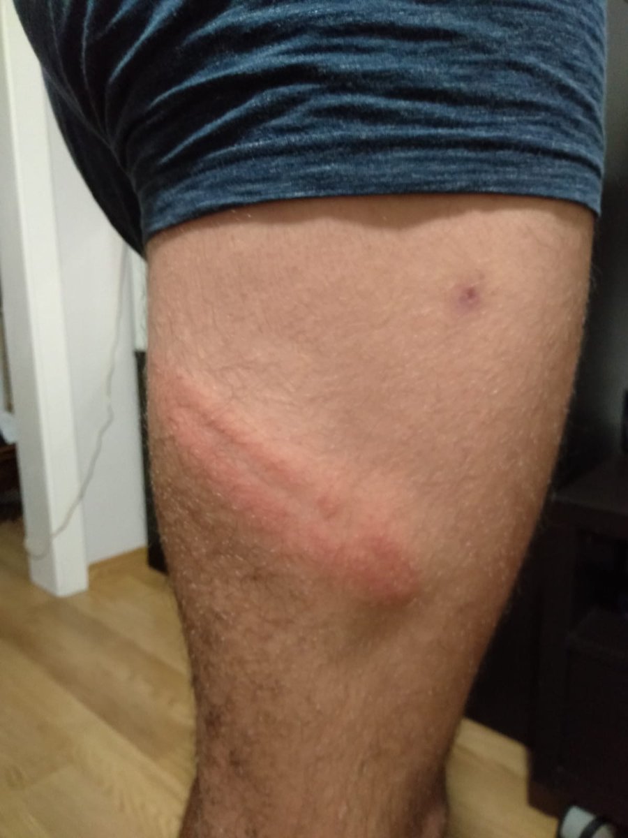 mgbmgb71's tweet image. Quan els teus fills arriben així, quan amb el grup d'amigues s'han hagut d'amagar a restaurants i portals fins poder arribar al metro, de veritat penseu q ens quedarem a casa? Els trobareu a ells i ens trobareu a les mares!!