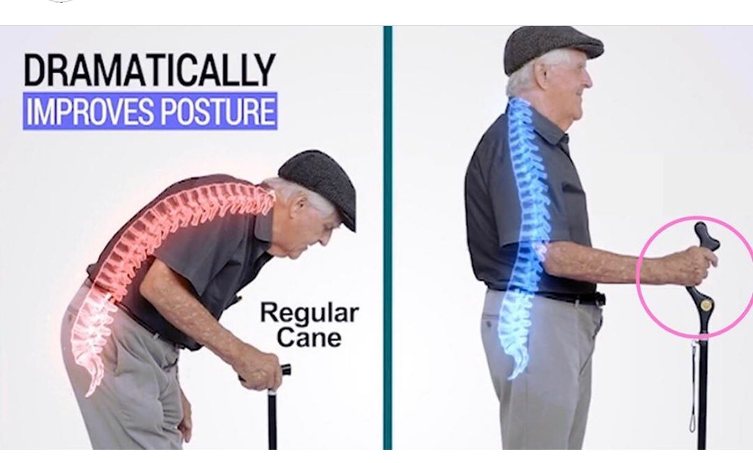UoEPhysioSoc's tweet photo. Can you spot the horrendous error?? Apart from the fact it's apparently a magic walking aid, someone clearly didn't know anything about anatomy when producing this advert #advertfail #failing #essexuni #studentphysio #physiotherapy #anatomy https://t.co/eVxkaU4tFT