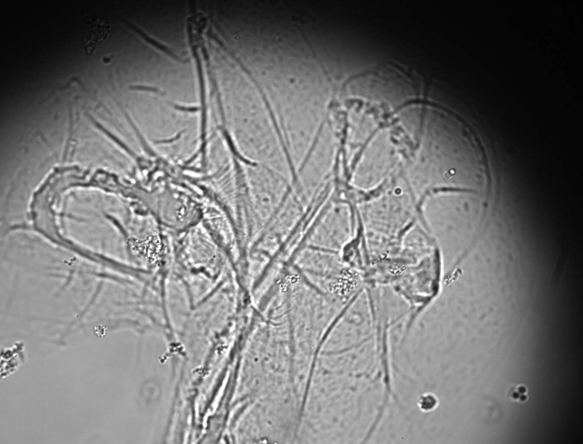 my scariest #microscreepy image 💀 

#FUS fibrils and aggregates, taken using DIC