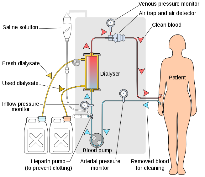 atdwaterspecial's tweet photo. ATD Water Specialists keeping you informed.

What are your kidney's?
Why would you need dialysis? 

https://t.co/SrncLYd1wJ

https://t.co/n4FUMwxeRX

#kidneypatient #kidneydisease
#kidneypatients #dialysis
#Hemodialysis #dialysiscentre #dialysistreatments #dialysisjamaica https://t.co/KyN5dV51fN
