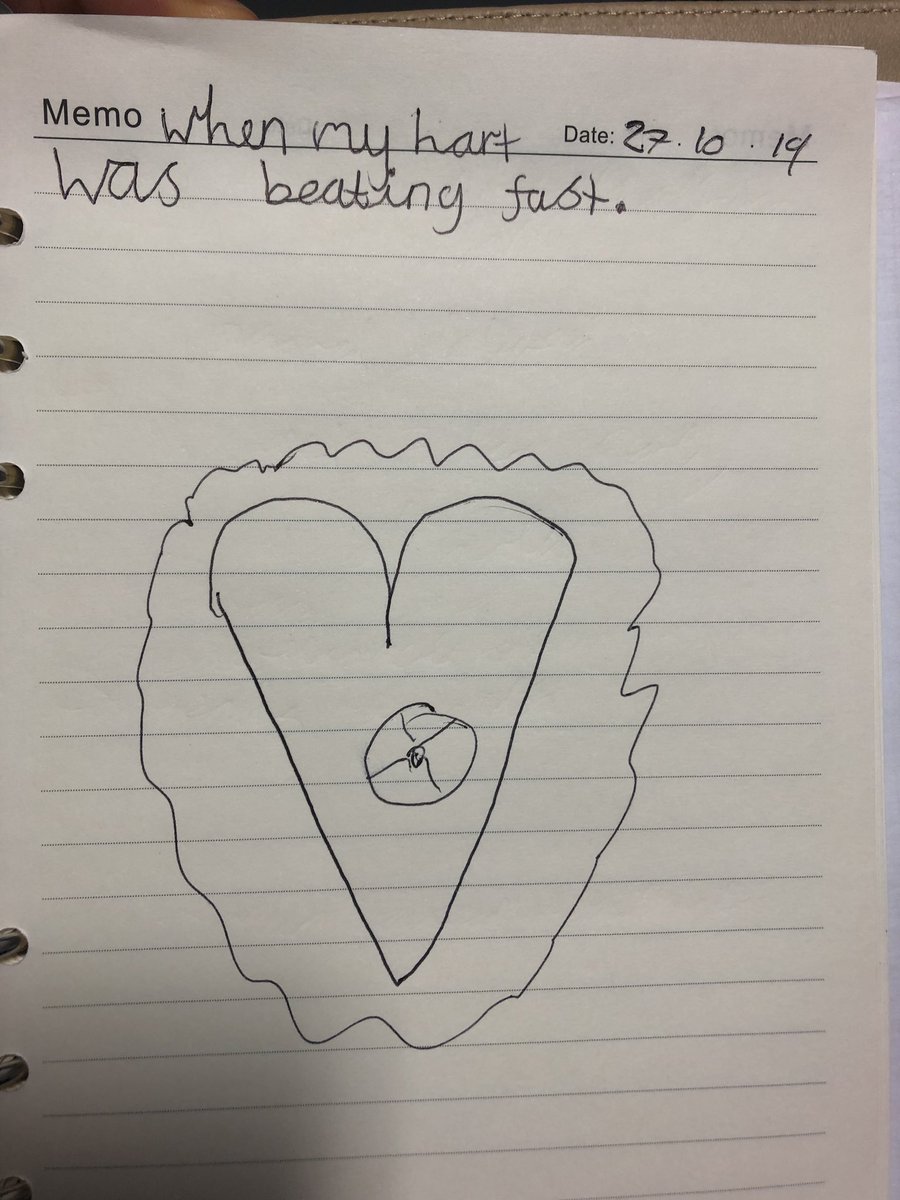Pictoral depiction of when 6 yo Lauren’s “Hart was beating fast”. That’s an electricity ball in the middle apparently. <a href="/RLHPED/">RLH Paeds ED/Trauma</a>