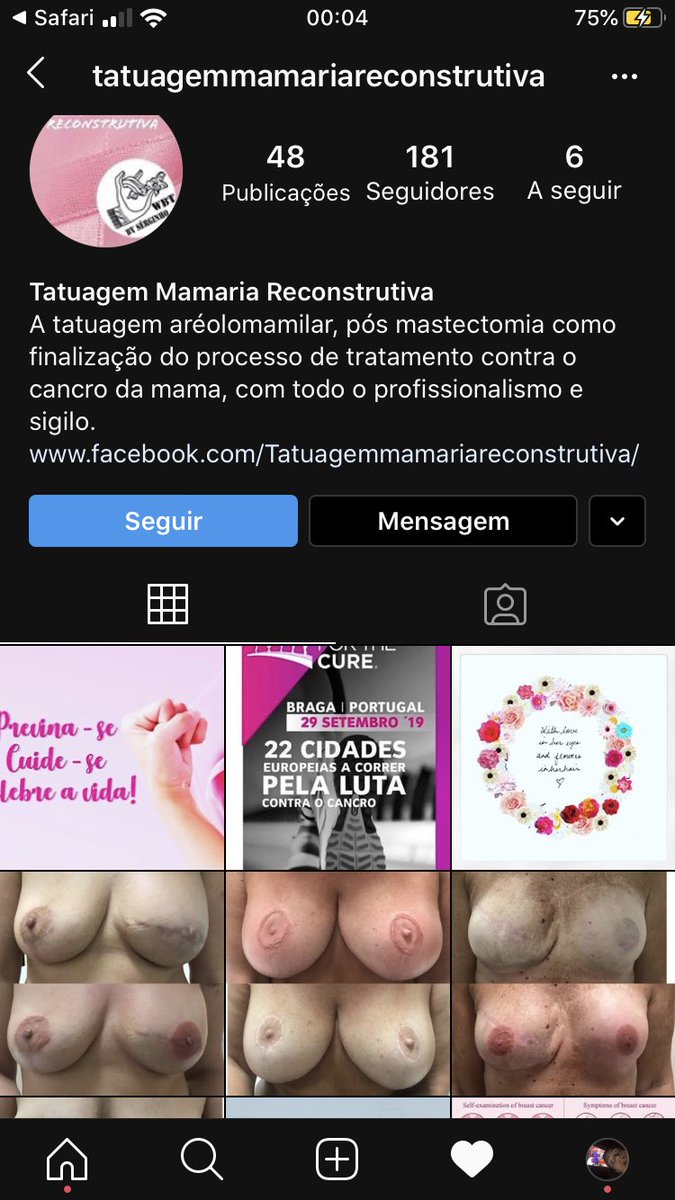 ariana_c17's tweet photo. Sei que vão ignorar isto, mas estamos no mês rosa e o meu pai tem um projeto de reconstrução da auréola da mama de quem teve cancro, q com este problema teve de retirar a mama e os mamilos. 
Isto tudo é feito com tatuagem com efeito 3D, todas as mulheres que aderiram à este... https://t.co/3UH5J95hb1