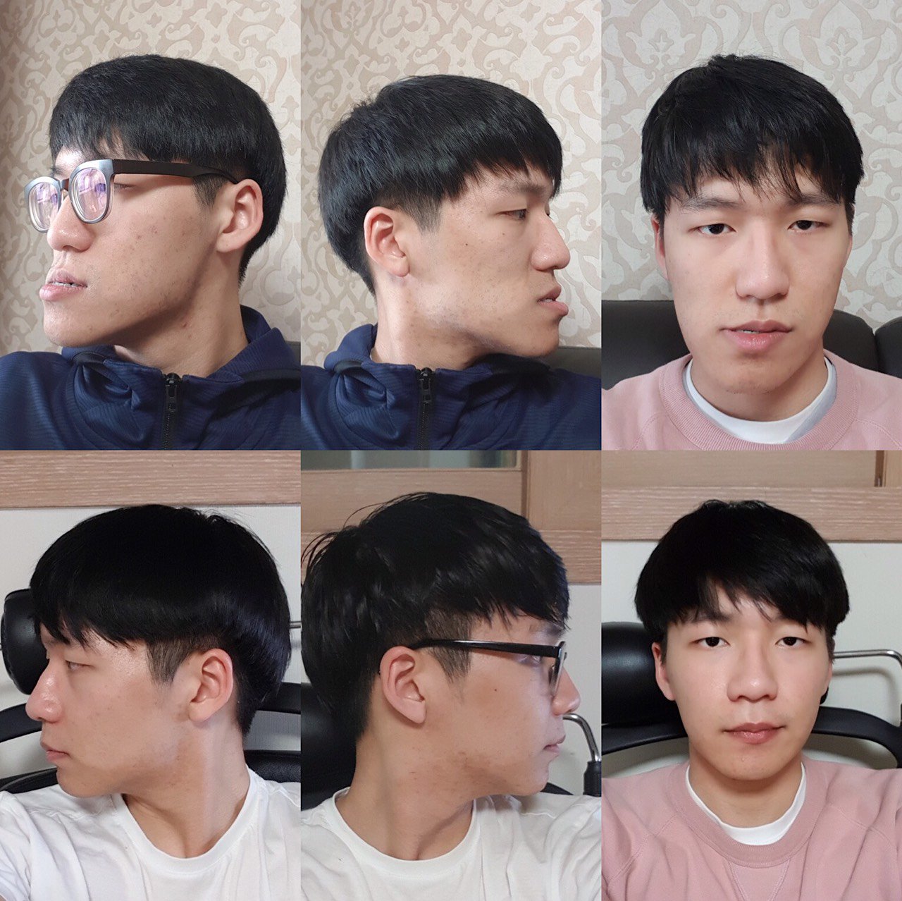 Facedesign お問い合わせ Line T Co 4ozrgba4jk非対称手術専門 両顎専門 口腔外科専門医私たち Facedesignにお任せください 両額 非対称手術 しゃくれた顎 受け口 美容整形 韓国美容整形外科 口腔外科専門 輪郭 Facedesign お問い合わせ Line T Co 4ozrgba4jk非対称手術専門 両顎専門 口腔外科専門医私たち Facedesignにお任せください 両額 非対称手術 しゃくれた顎 受け口 美容整形 韓国美容整形外科 口腔外科専門 輪郭
