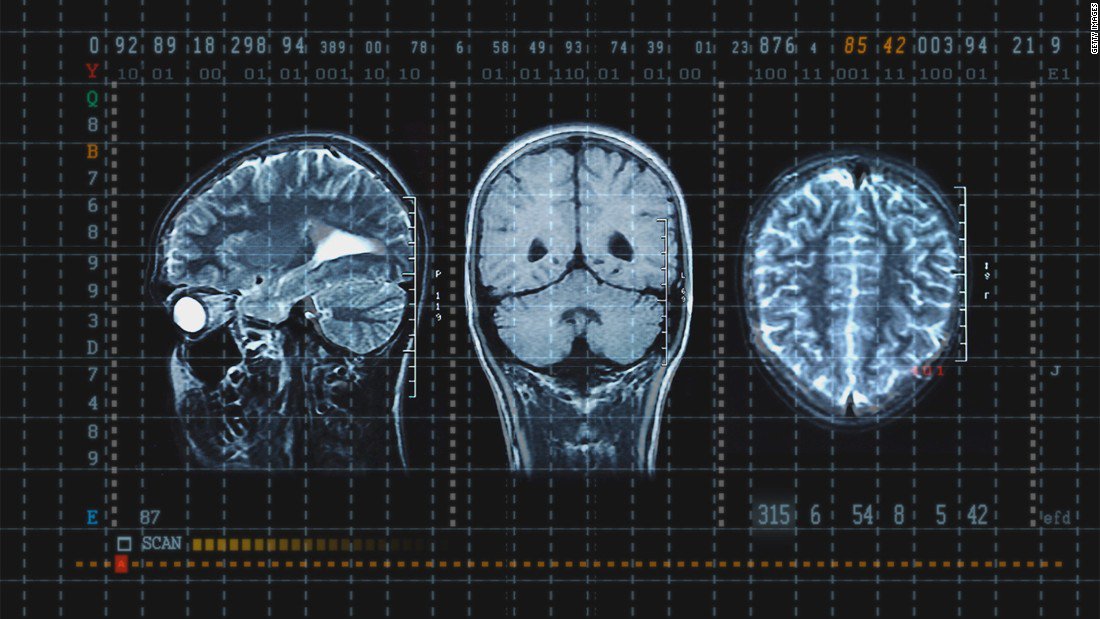 statcare's tweet image. These high school sports have the highest concussion rates ecs.page.link/pcHgm 
...
#statcare #concussiontesting #concussion #sports #highschool #urgentcare #newyorkurgentcare