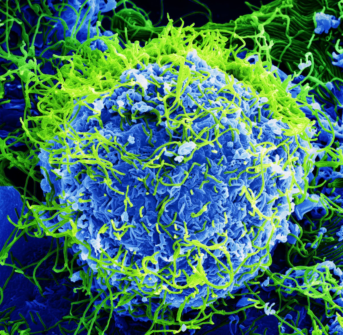 wiki_science's tweet photo. Images from #WikiScienceCompetition2017

Today, we present a finalist in the "microscopy" category from 🇺🇸: #SEM image of #Ebola virus particles (green) from a chronically-infected African Green Monkey #kidney cell (blue). #NIAID

CC BY-SA 4.0 John Bernbaum 2017 Wikimedia Commons https://t.co/ytdCpJaZIR