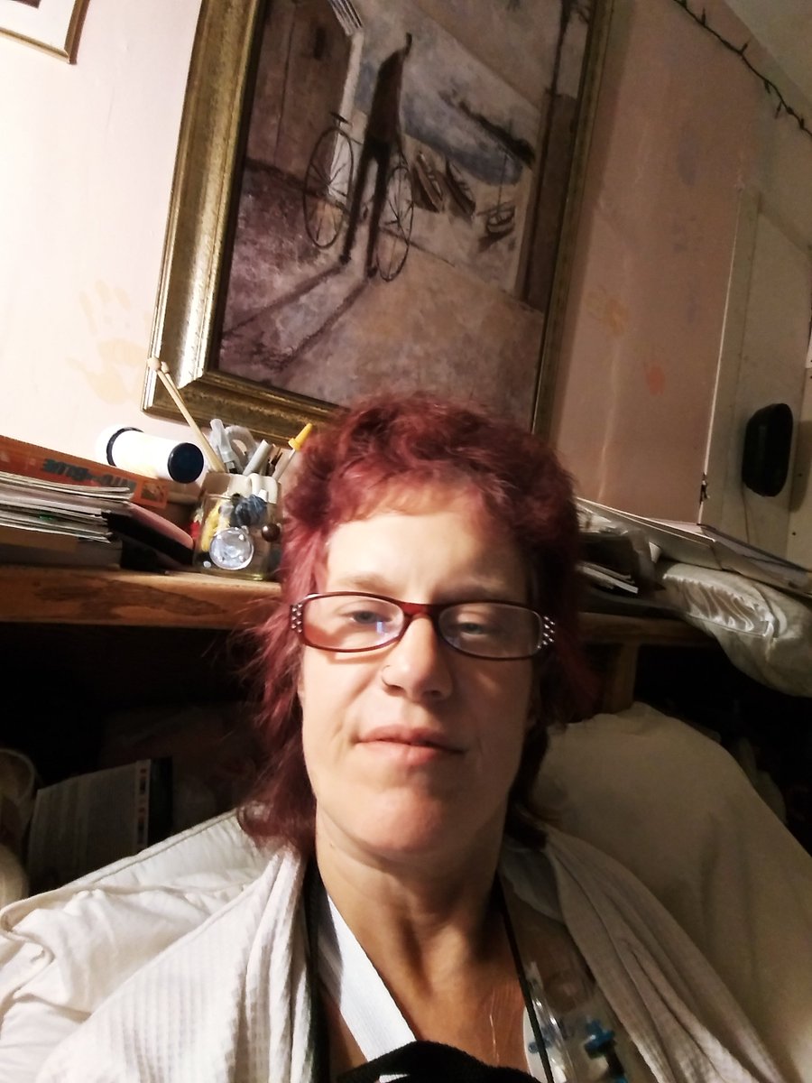 ScarloFolsom's tweet image. broke my wrist September 27th . It was declared non-operational October 4th. October 7th it had slipped, was declared #operable. Yesterday October 15th I had the operation. This is post operation about 24 hours after. #rest #beautiful