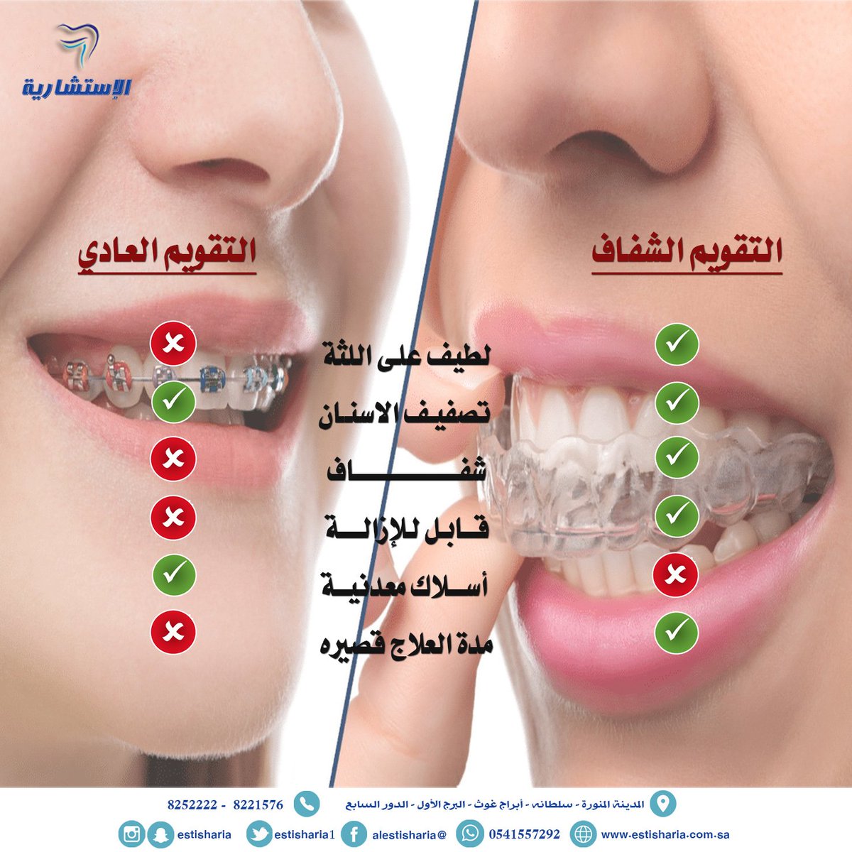 الإستشارية On Twitter الفرق بين التقويم الشفاف الإنفزيلاين والتقويم العادي الدكتور إبراهيم مصطفى زيتوني استشاري تقويم الأسنان الاستشارية لطب الأسنان المدينةالمنورة سلطانه ابراج غوث البرج الأول الدور السابع 0541557292 8252222 Https T Co