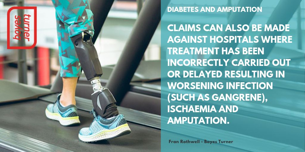 As amputation lawyers we have seen the impact of an amputation on our clients' lives - here Fran Rothwell talks us through the links between #Diabeticfootcare and possible #amputation and how when the worst happens a #MedNegLawyer might be able to help ow.ly/p0K850wGmG3