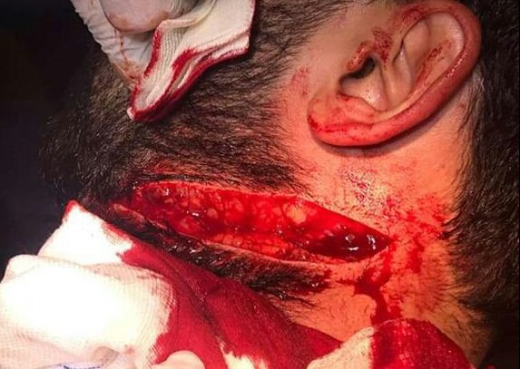 Bu görüntü ülkemde doktor öldürmenin ne kadar kolay olduğunun görüntüsü.
Her geçen gün "acaba eve sağ salim gidebilecek miyiz" diye düşünen bir meslek grubuna dönüşmeye devam ediyoruz.
EN ACISI DA ŞU Kİ; ALENEN ÖLDÜRÜLMEYE ÇALIŞILMAMIZ KİMSENİN UMRUNDA BİLE DEĞİL.
#doktorsuzkalın