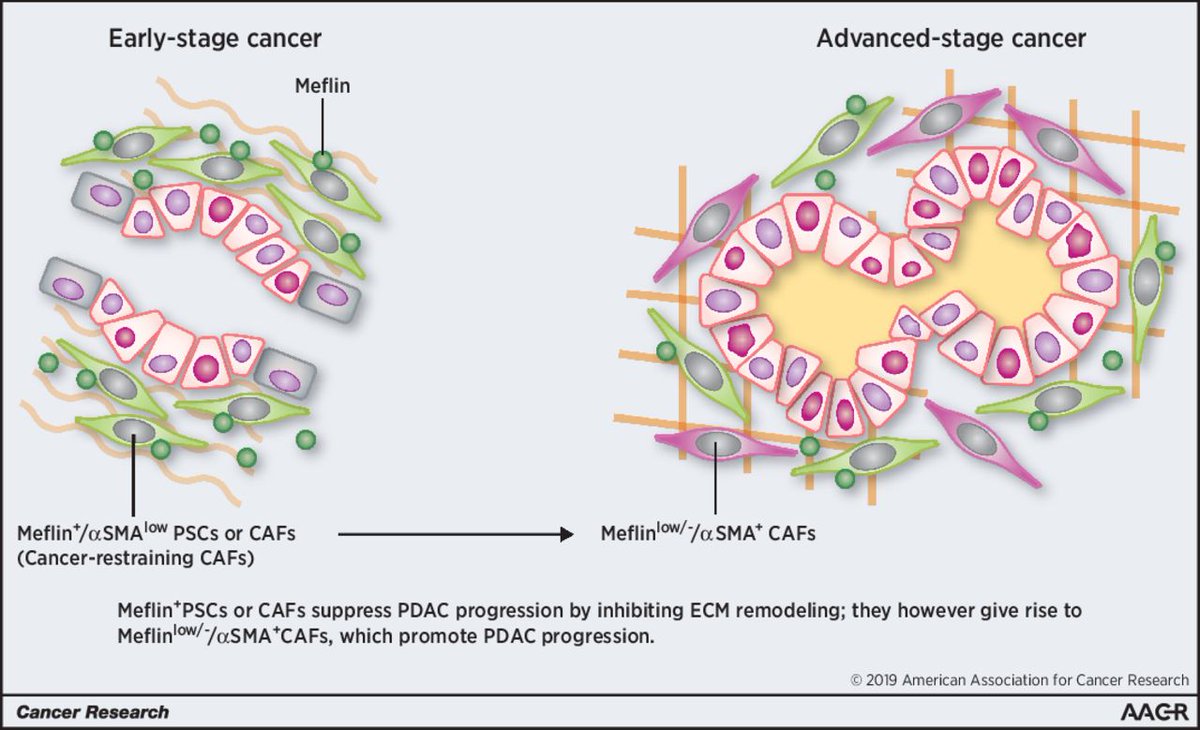Atsushi Enomoto (@atsushi_enomoto) on Twitter photo Our paper on the identification of cancer-restraining fibroblasts in PDAC appeared in current issue of <a href="/CR_AACR/">Cancer Research</a>🍻 We thank <a href="/danworthley/">Daniel Worthley</a> and Susi at <a href="/sahmriAU/">SAHMRI</a> and the Wisconsin team for inspiring us😆 Great work by Mizutani san, Kobayashi kun, Iida san👏 cancerres.aacrjournals.org/content/79/20/… Our paper on the identification of cancer-restraining fibroblasts in PDAC appeared in current issue of <a href="/CR_AACR/">Cancer Research</a>🍻 We thank <a href="/danworthley/">Daniel Worthley</a> and Susi at <a href="/sahmriAU/">SAHMRI</a> and the Wisconsin team for inspiring us😆 Great work by Mizutani san, Kobayashi kun, Iida san👏 cancerres.aacrjournals.org/content/79/20/…