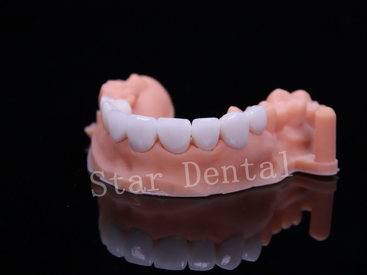 Zirconia crowns and Emax veneer with digital printing model😊
#dentalhealth #digitaldental