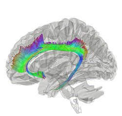 INSneuro's tweet photo. All you wanted to know about the #cingulum bundle. Emma J. Bubb, Claudia Metzler-Baddeley, John P. Aggleton, 2018, Neuroscience & Biobehavioral Reviews.
https://t.co/3kplAaYtOW https://t.co/itCd9t0rAp