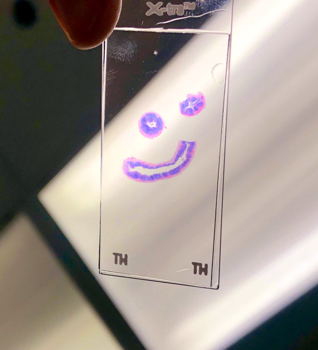 K_JohnsonMD's tweet photo. That feeling when you know itโs going to be a good day, despite jet-lag and being post-call because your slide is winking at you. Always look on the #PathSide of life :-) #pathology #PathologyResidents https://t.co/5eHFIKoi8M