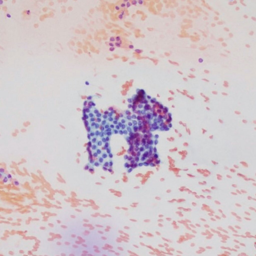 pathologistwife's tweet photo. Benign thyroid follicular cells or Monopoly dog? 
#ENTpath #CytoPath #pathart https://t.co/Gl5vyxeWOX