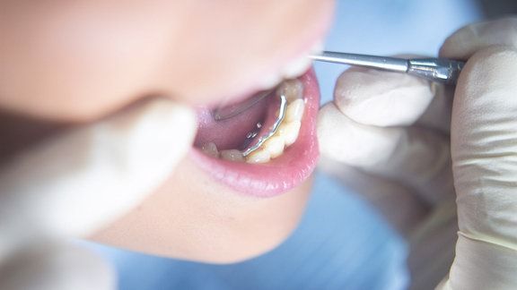 ProfDhomPartner's tweet image. Eine seit Jahrzehnten existierende Alternative zu Implantaten, die einzelne Zähne ersetzen sollen, ist die Brücke. Welcher Zahnersatz eignet sich für welchen Fall?

buff.ly/35GOYqy