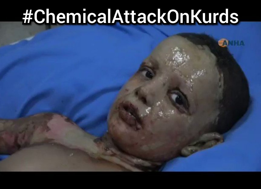 How many more Kurds must die, before the world intervenes?

#ChemicalAttackOnKurds