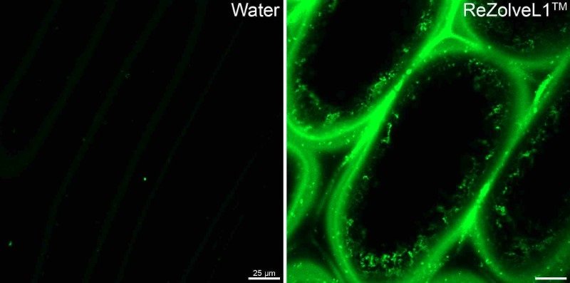 A #FluorescentFriday shout-out to all researching #plantcells! ReZolve's range of #fluorophores for #microscopy are versatile, quickly absorbed &amp; for use on live and fixed samples.  Image:ReZolve-L1 on onion cells vs water. More at rezolvescientific.com