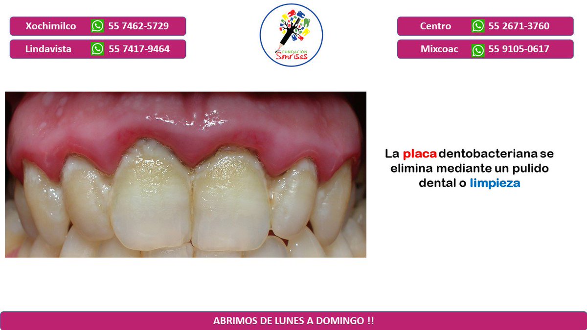 cdmilsonrisas's tweet photo. Recuerda que en Fundación Mil Sonrisas  el pulido dental y eliminación de sarro tienen un costo de $100 pesos cada uno ¡te esperamos en cualquiera de nuestras sucursales! #sonreirnocuestanada #dentista #clinicadental https://t.co/Wx1DikFntz