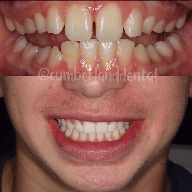 Cumberland Dental on Twitter "What a great end to a busy week at the