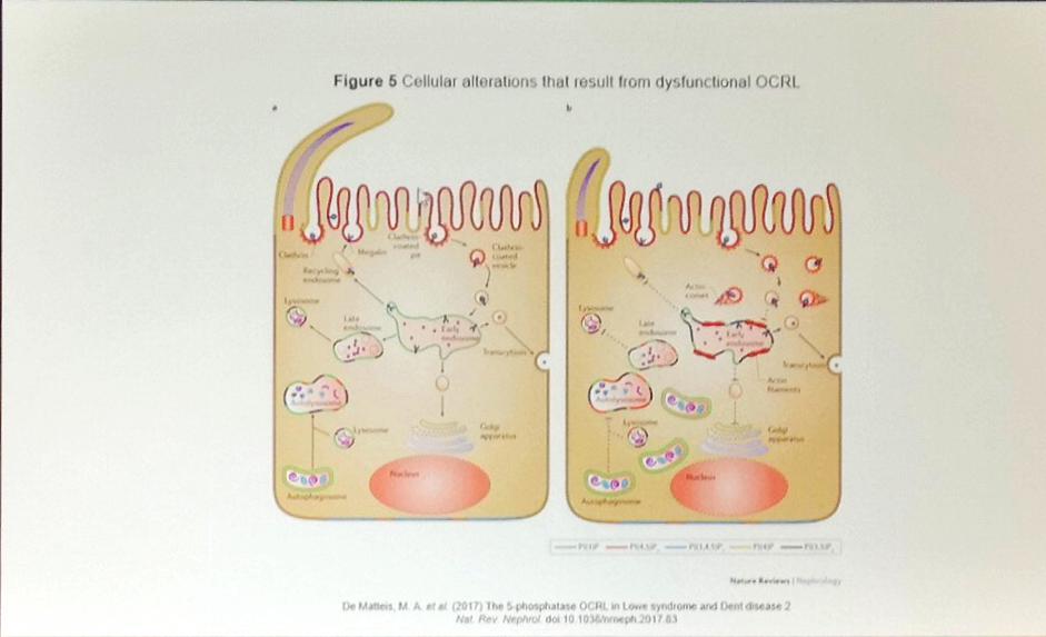 BAPNnephrology's tweet photo. Phosphoinositide interaction with actin is implicated in numerous cell functions accounting for the implication of the #OCRL gene in a wide range of clinical syndromes #Lowe #Dent-2 #IPNA2019 https://t.co/tjQaeVzw70