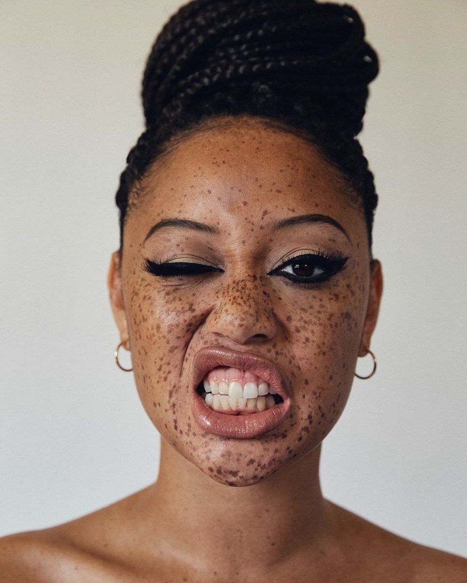 afrodyssee's tweet photo. SALEM
Salem Mitchell by Samuel Paul @salemmitchell #salemmitchell #samuelpaul #portrait #fleckles #africanbraid #america #geneva #afrodyssee https://t.co/VVta2dVAf3