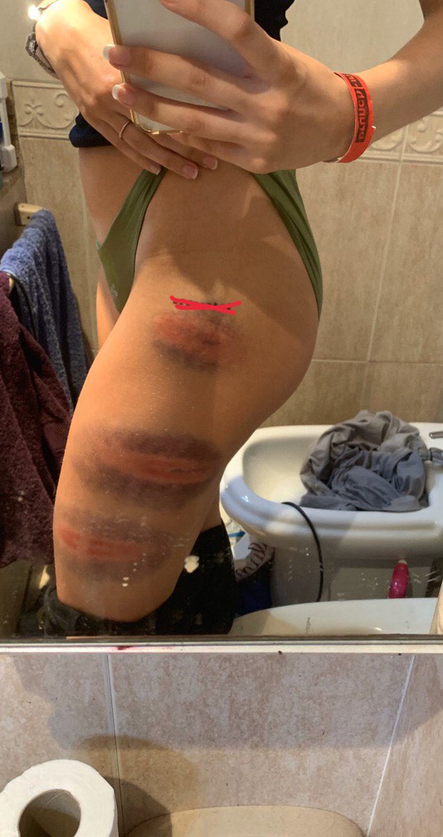 así dejan los mossos despues de las cargas de ayer a la gente 🤦🏻‍♀️