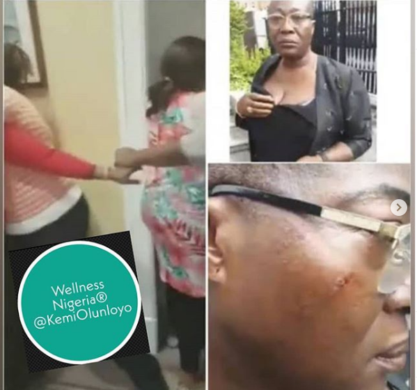 DonaldRex's tweet photo. BREAKING: #DublinBlogger Down With PTSD, Details, 10pm #LIVE With #KemiOlunloyo https://t.co/TqsowJFwlZ https://t.co/CGsdz0IecY
