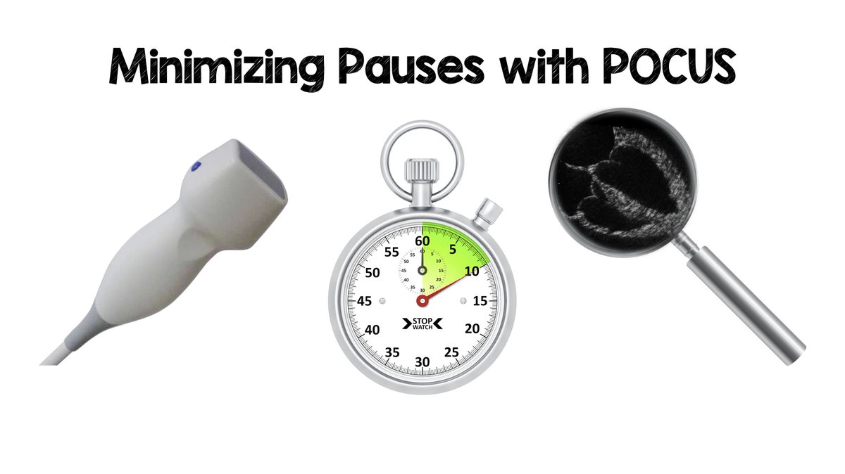 Minimizing Pauses with POCUS in OHCA...

1. Place phased array probe on subxiphoid when CPR is ongoing
2. Have someone count outloud to minimize pause
3. Don’t interpret while recording, hit record on ultrasound &amp; interpret after CPR resumed

#EMSWorldExpo2019 #FOAMed #FOAMcc
