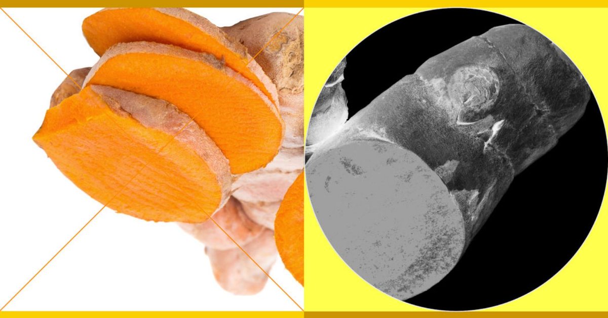 AltPantry's tweet image. Turmeric and curcumin: Are any of the claimed benefits real? Maybe, maybe not, reports @nytimes. The jury is still out. More from NYT's interesting new series examining the science behind popular wellness trends. #turmeric #curcumin buff.ly/2BkaXFD