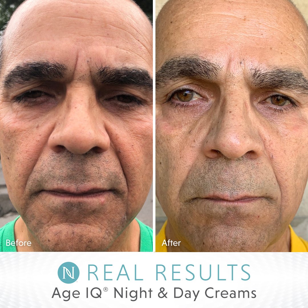 Neora on Twitter: &quot;“After using Neora&#39;s Age IQ Night &amp; Day Cream for 90  days, I feel like I look at least 5 years younger! I can see a difference  every day